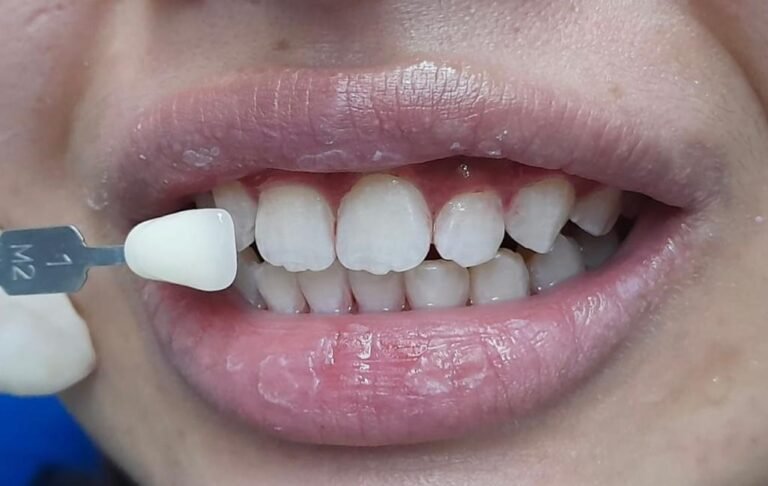 WhatsApp Image 2025-08-11 at 1.01