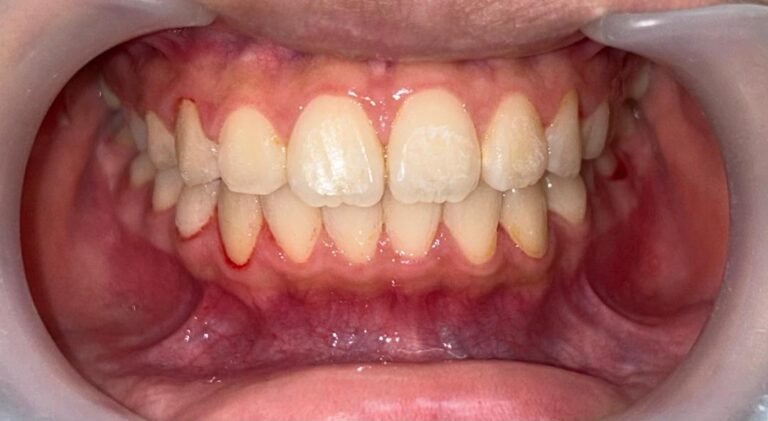 WhatsApp Image 2025-08-11 at 1.08